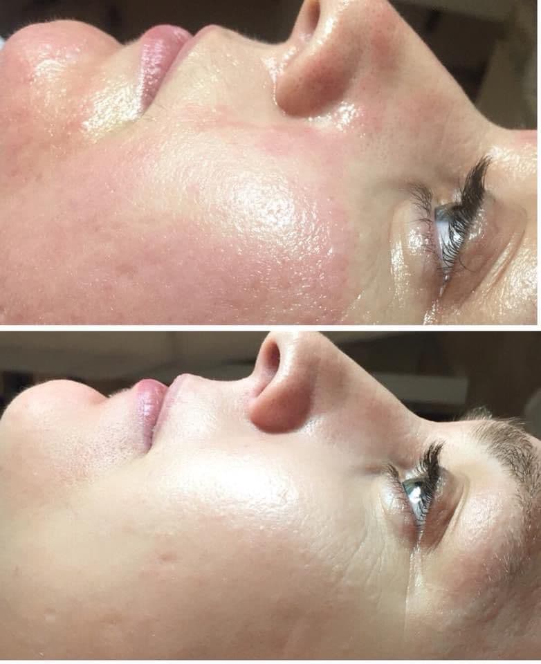 Tratamente de Dermato Cosmetică la Slim & Beauty by MC