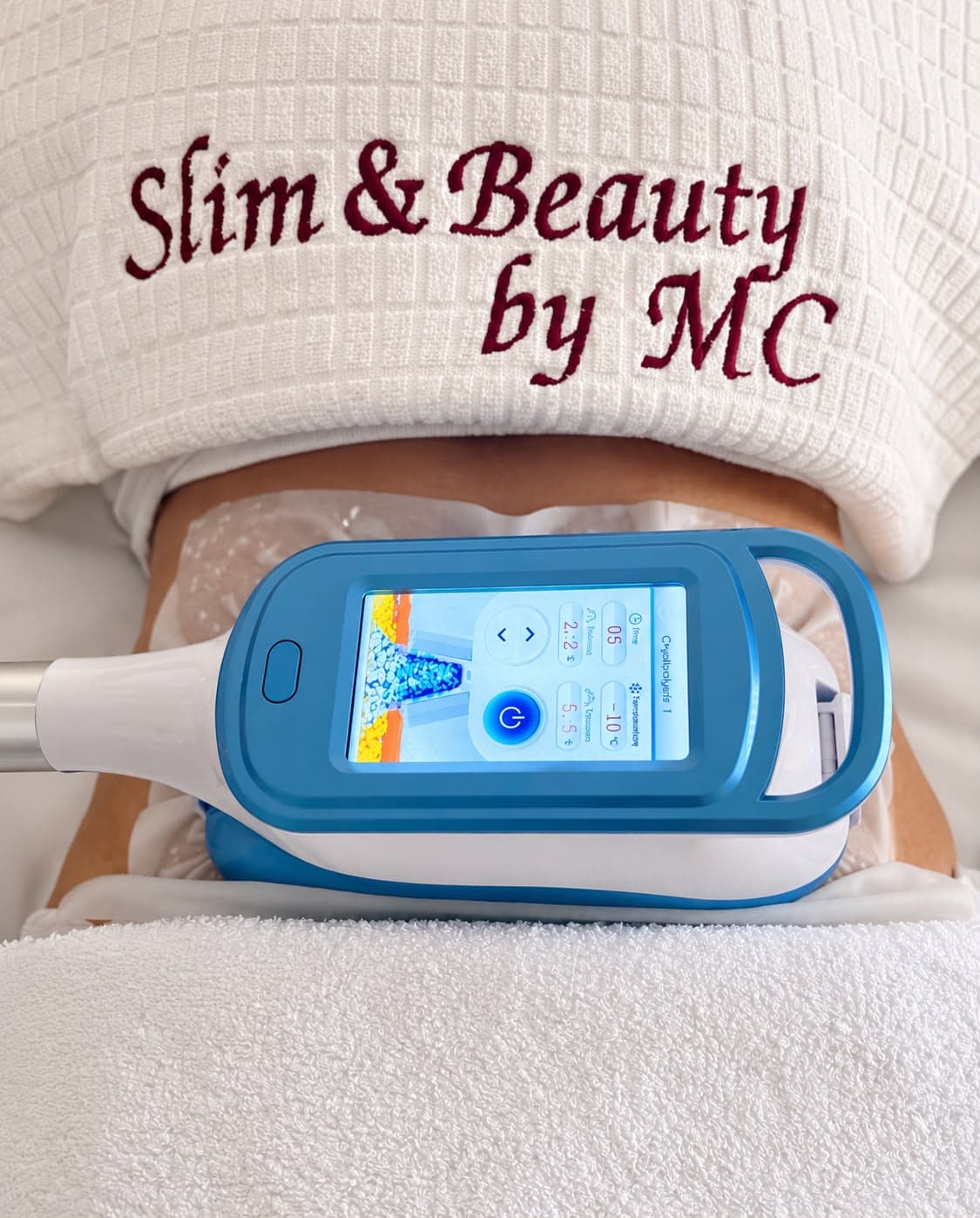 Aplicator de criolipoliză pe abdomenul unei cliente, sub prosopul brodat Slim & Beauty by MC